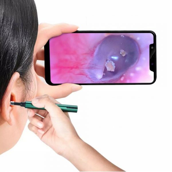 WI-FI Enabled HD Wireless Otoscope Earwax Remover Visual Ear Cleaner_0