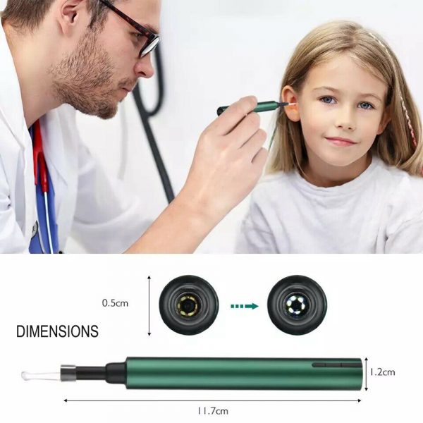 WI-FI Enabled HD Wireless Otoscope Earwax Remover Visual Ear Cleaner_5