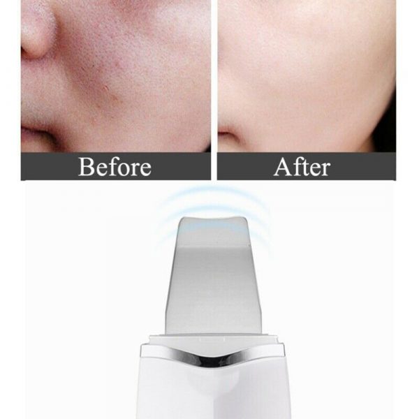 Ultra-Sonic Deep Facial Skin Cleansing Machine Facial Scrubber_5