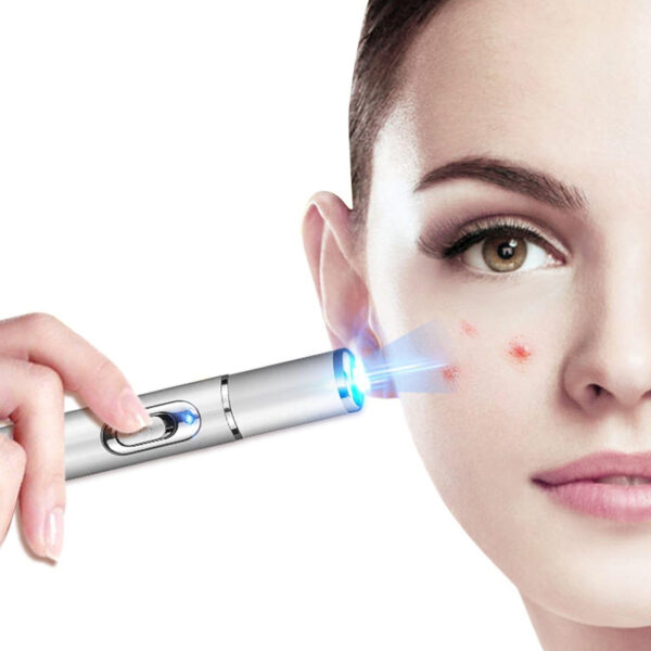 Electronic Acne Removal Pen Powerful Skin Stain Remover- Battery Powered_9