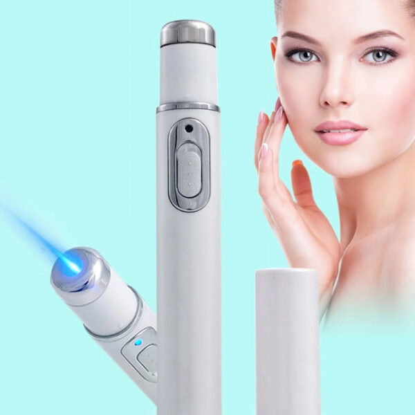 Electronic Acne Removal Pen Powerful Skin Stain Remover- Battery Powered_4