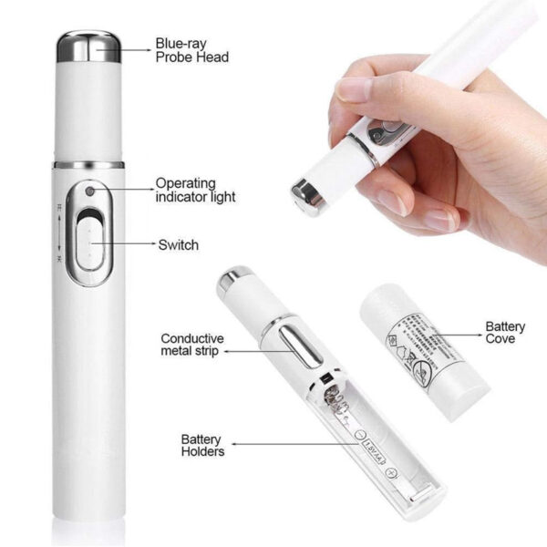 Electronic Acne Removal Pen Powerful Skin Stain Remover- Battery Powered_8